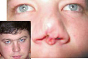 За откушенный нос мужчина заплатит 4 миллиона (фото)
