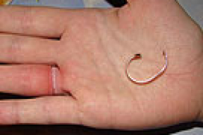 Дважды за сутки МЧС помогало девушкам снимать обручальные кольца
