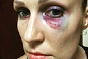 Белорусскую баскетболистку избили в Китае прямо на спортивной площадке