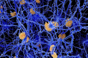 Предположительно, герпес ведет к Альцгеймеру. Что теперь делать?