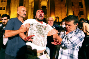 Как выступление депутата Госдумы привело к массовой акции протеста в Тбилиси. Главное