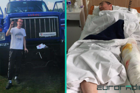 МВД пояснило, как получил травмы мужчина, которому ампутировали часть ноги