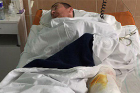 После задержания и ночи в вытрезвителе гродненцу ампутировали часть ноги