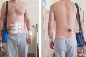 «С пары метров расстреляли. Кишки были наружу». История парня, в которого прилетело две пули